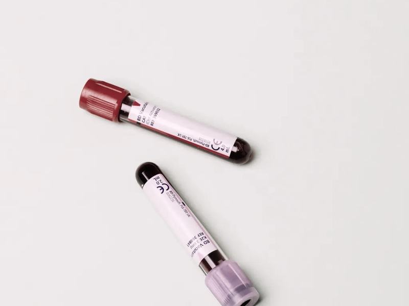 Two blood collection tubes.