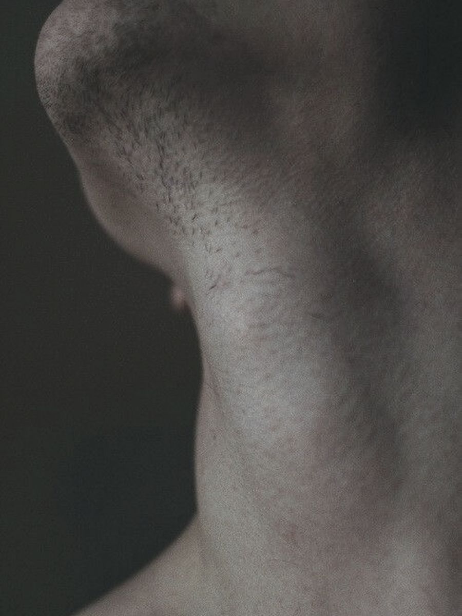 Hormones and thyroid