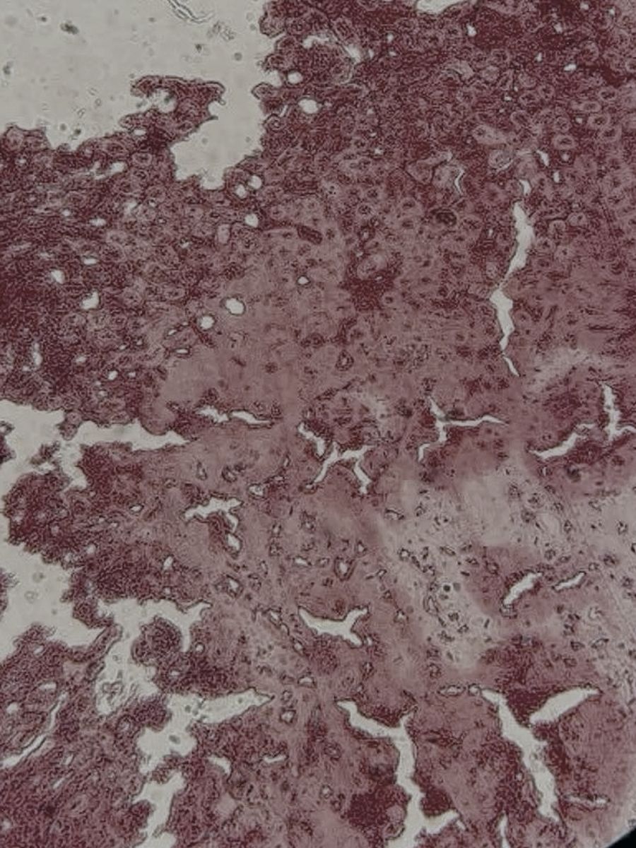 Metabolic and cardiovascular
